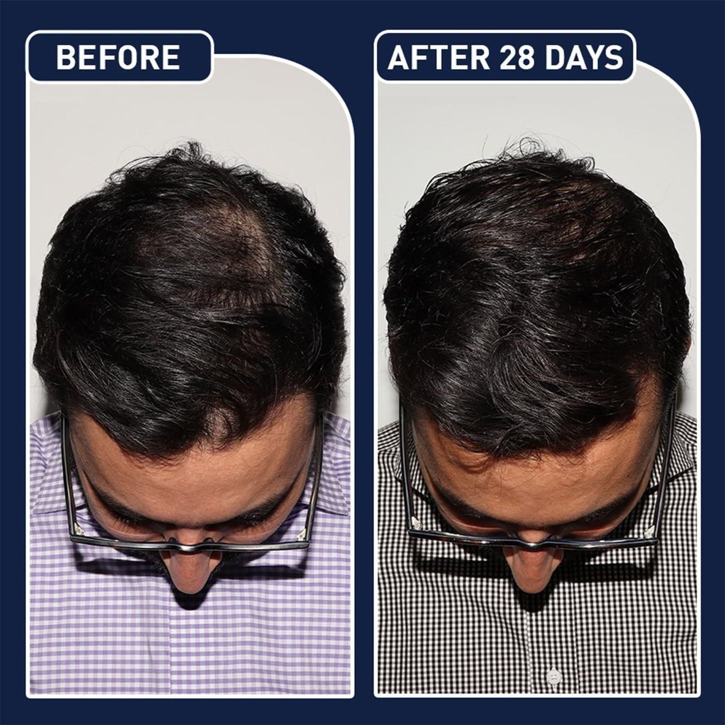 FEGplus Hair Fall Control Spray