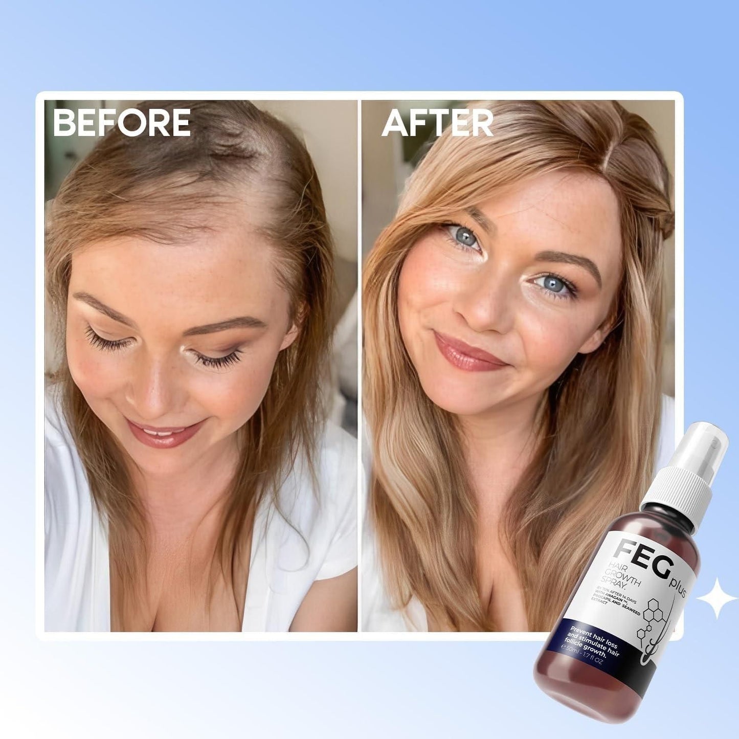 FEGplus Hair Fall Control Spray